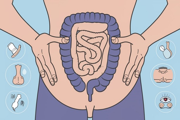 Sistokel Gejala, Pengobatan, dan Pencegahan untuk Kesehatan Panggul